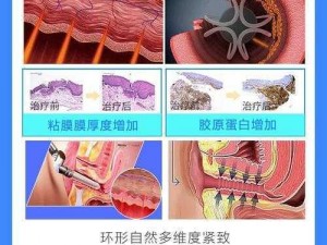 BXBXBXBX 幸老熟妇 XXX 私密紧致抑菌凝胶，关爱女性健康，提升夫妻生活质量