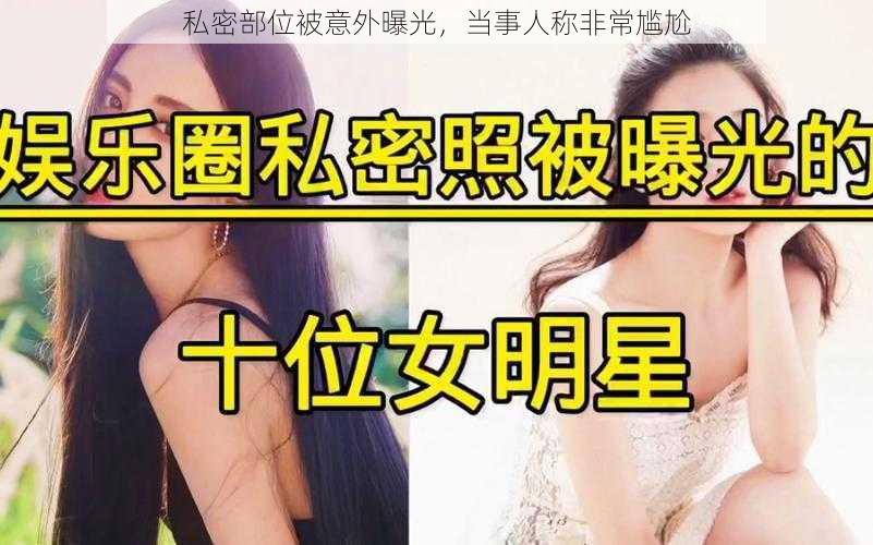 私密部位被意外曝光，当事人称非常尴尬