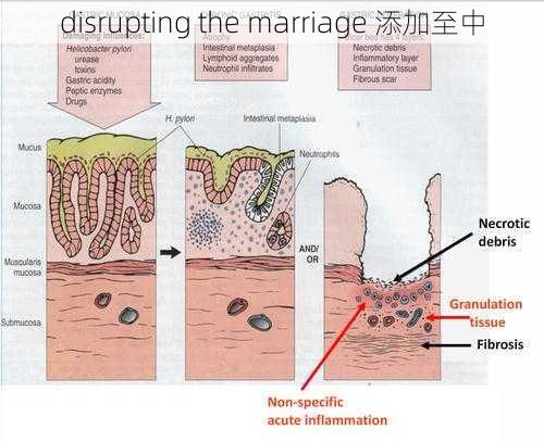 disrupting the marriage 添加至中