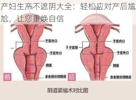 产妇生产不遮阴大全：轻松应对产后尴尬，让您重焕自信